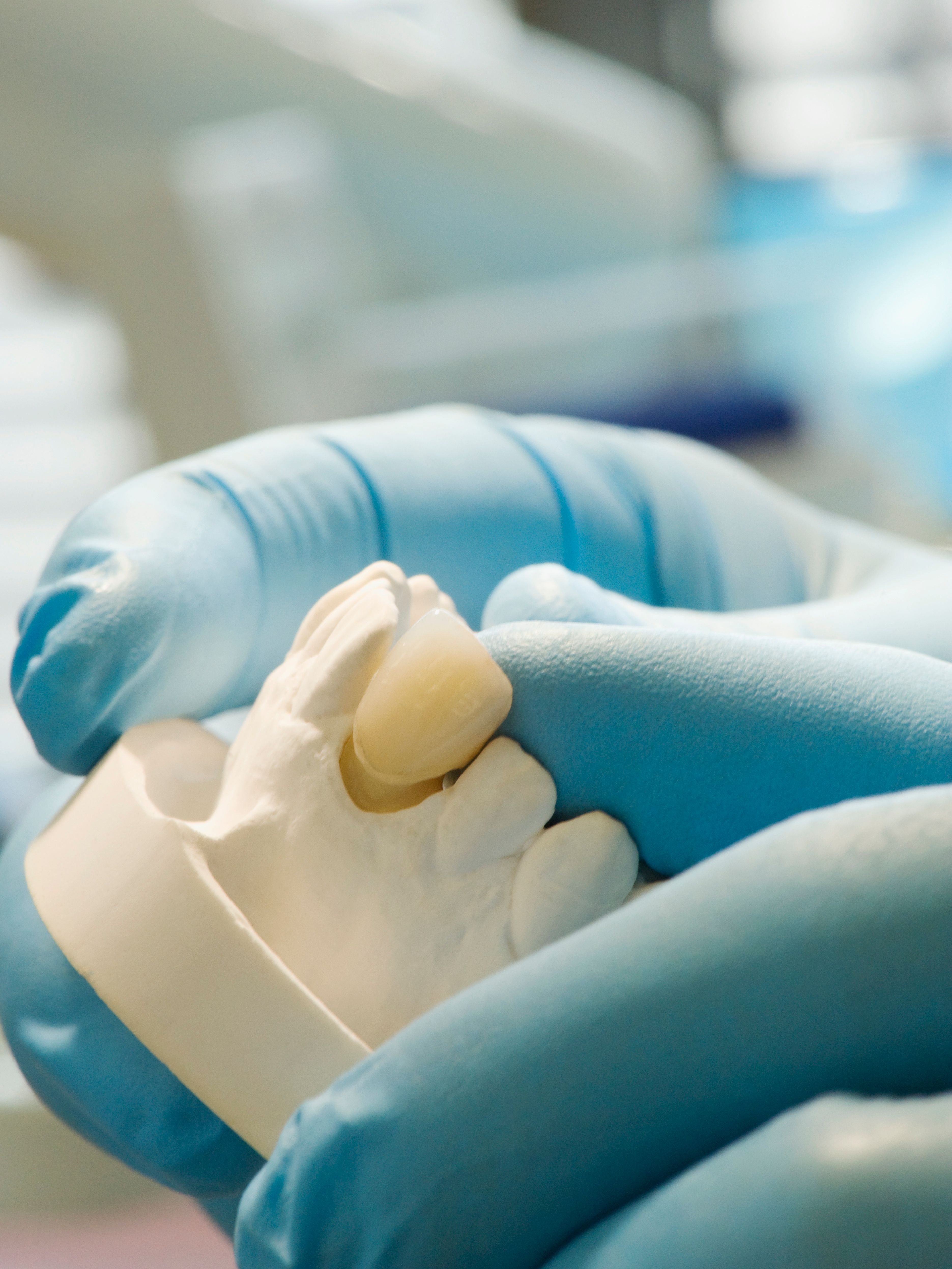 Forever Crown vs Traditional Crown: Durability and Cost Compared main image || ''