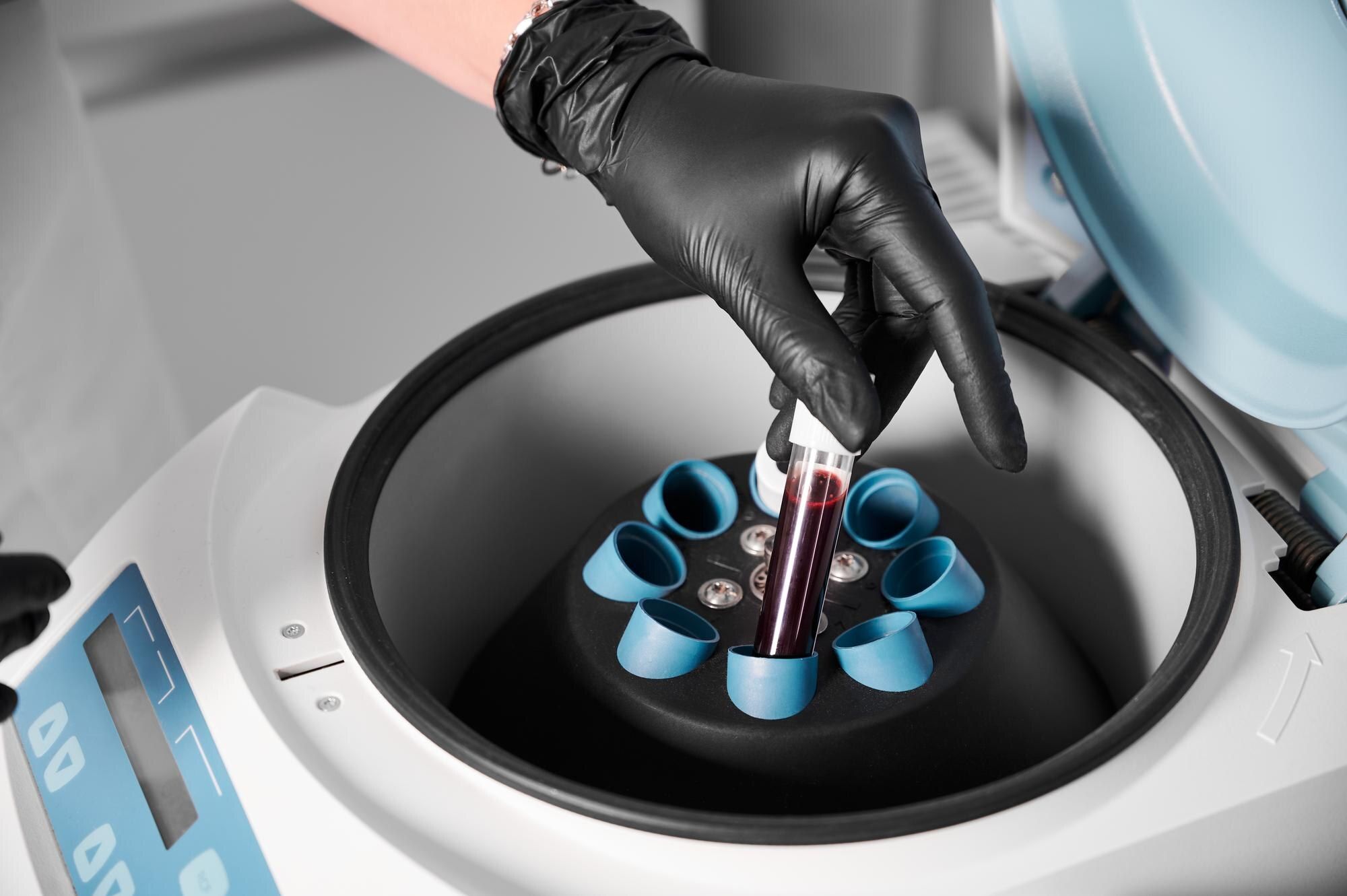 preparation-blood-injections-cosmetologist-puts-tube-blood-centrifuge 651396-2504